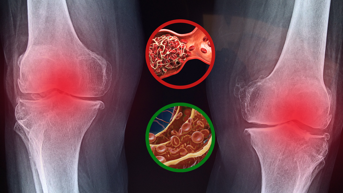 The Connection Between Knee Pain and Blood Flow